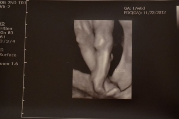 21 week ultrasound