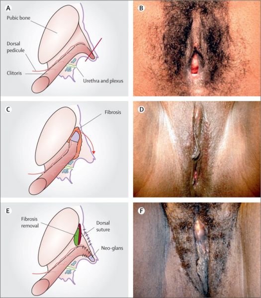 live genitals female diagrams