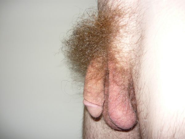 men with no pubic hair