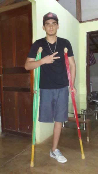 lak amputee male
