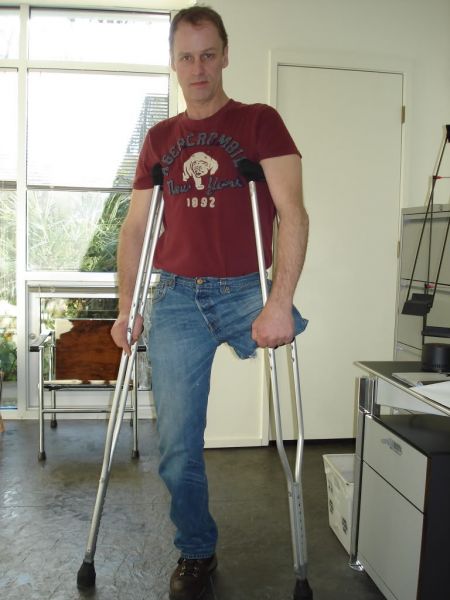 dude amputee crutching