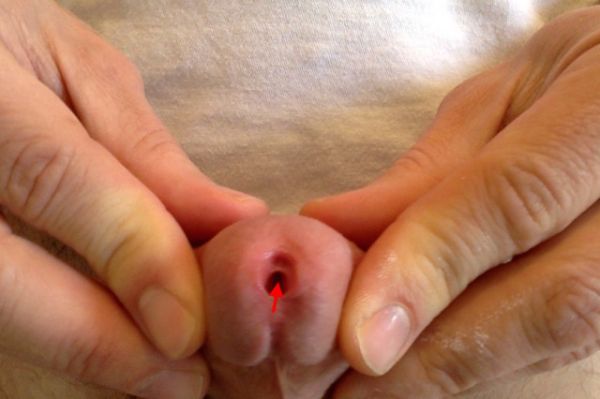 large male urethra opening