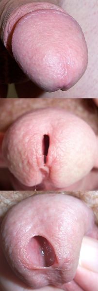 stretching the urethra opening male