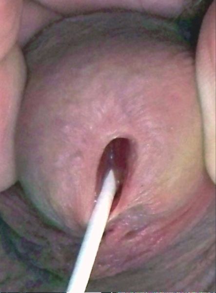 male urethra anatomy