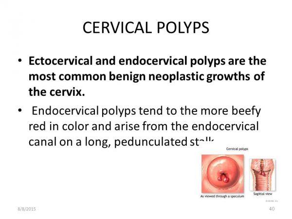cervix dilation