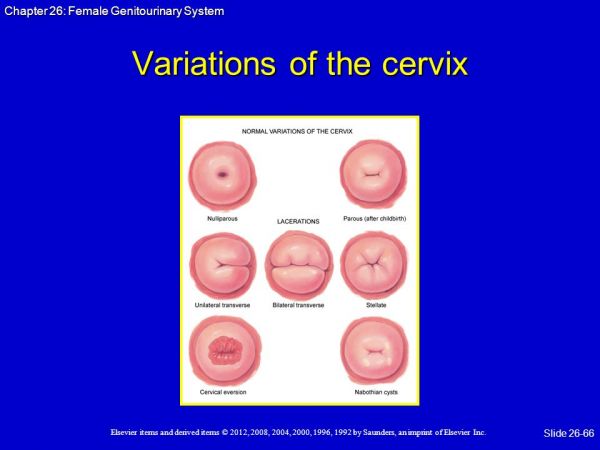 doctor says cervix looks irritated