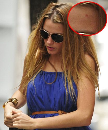 blake lively weight loss