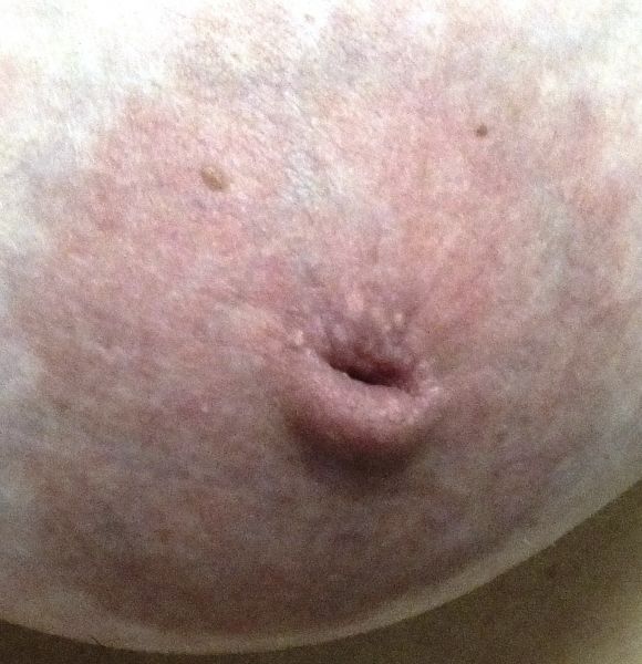 extreme nipple piercings woman