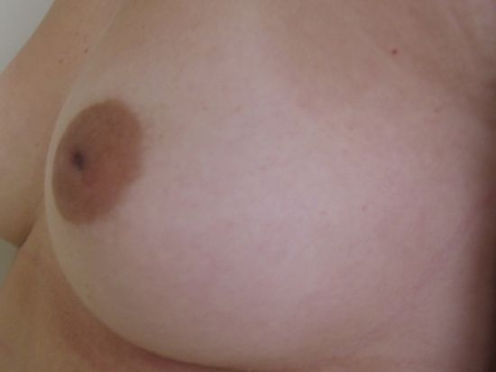 huge stretched nipples