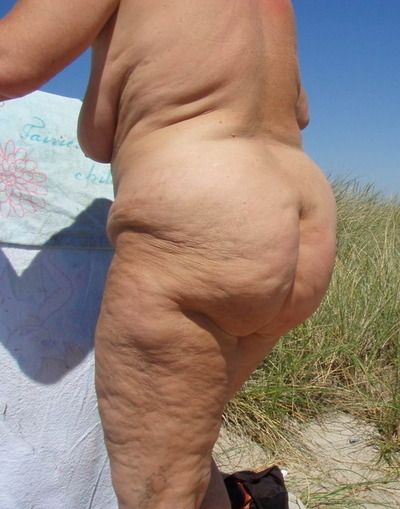 chubby cellulite