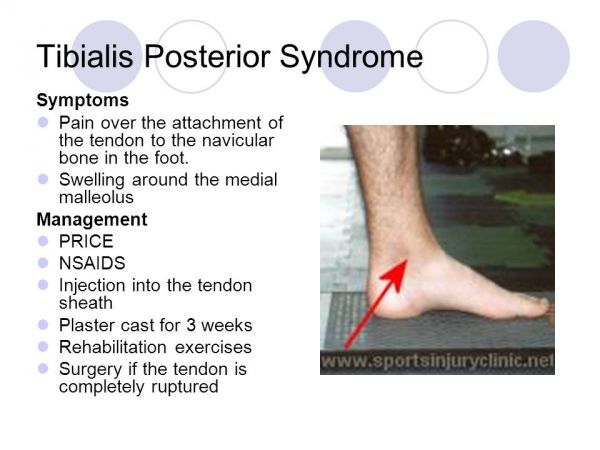 lateral ankle pain