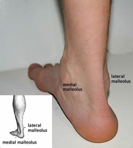 lateral and medial malleolus