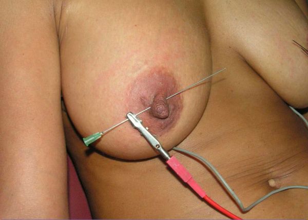 sharp needles in nipples