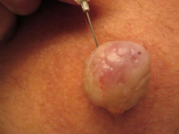 needles in her nipples