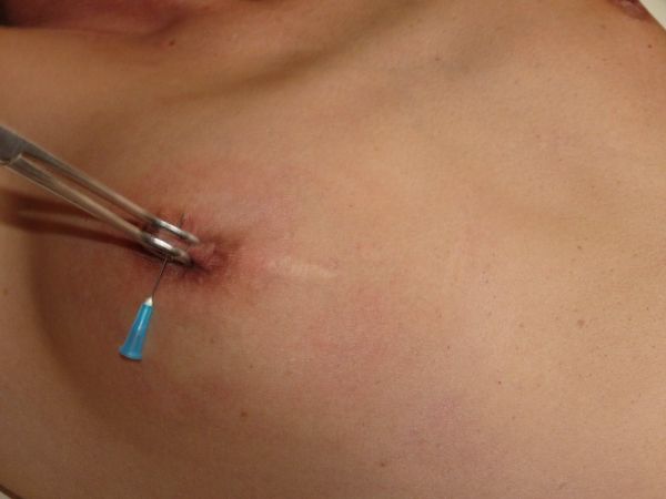 needles in nipples pix