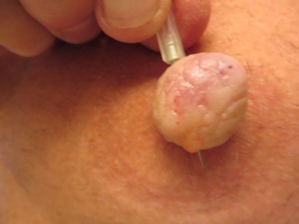 pushing needles in nipples
