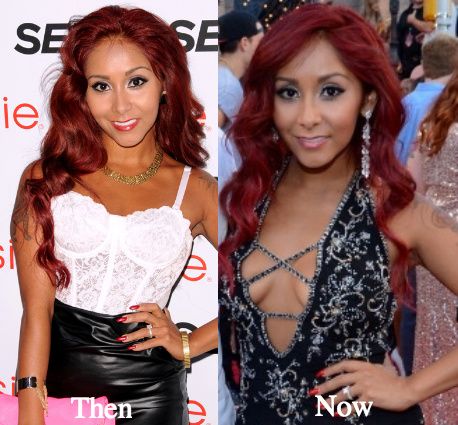 snooki teeth before and after