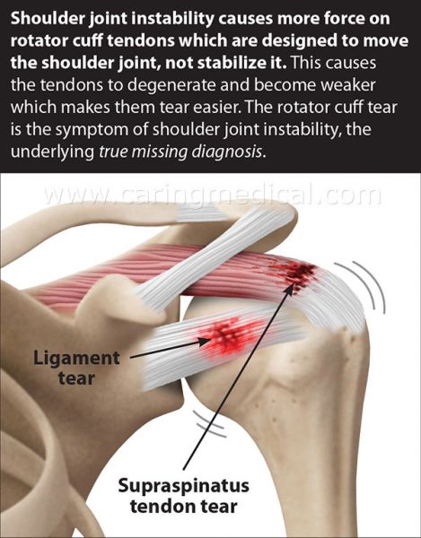 front shoulder pain