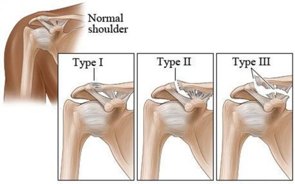 anterior shoulder anatomy