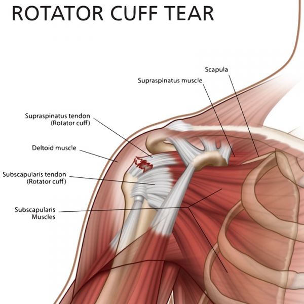 ac joint pain treatment