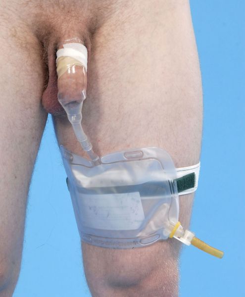 penis with catheter in it
