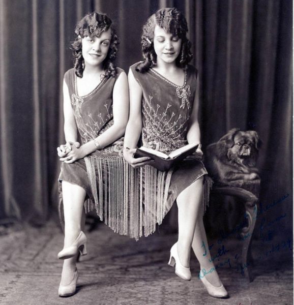 conjoined twins nude real naked