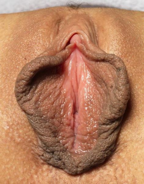 extreme labia world record