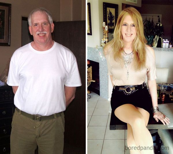 post op shemale before and after
