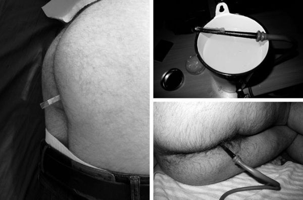 wife gives husband enema