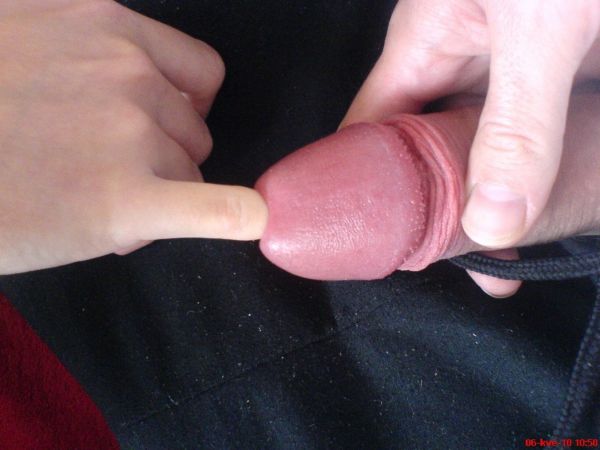 penis opening urethral stretching