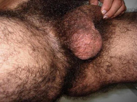 extremely hairy penis
