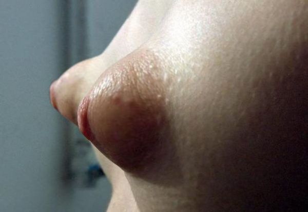 braless puffy nipples