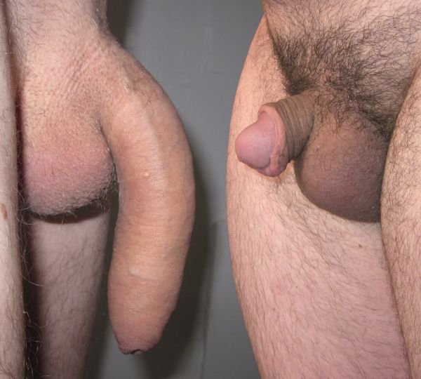 small flaccid penis