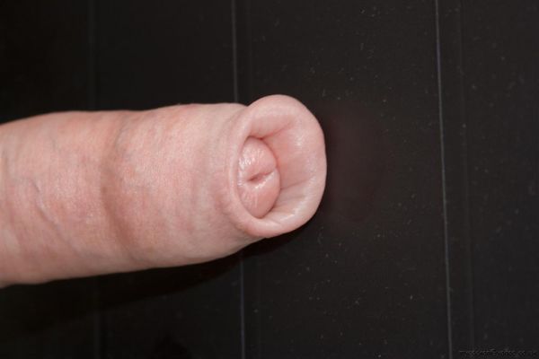 the complex foreskin ring block