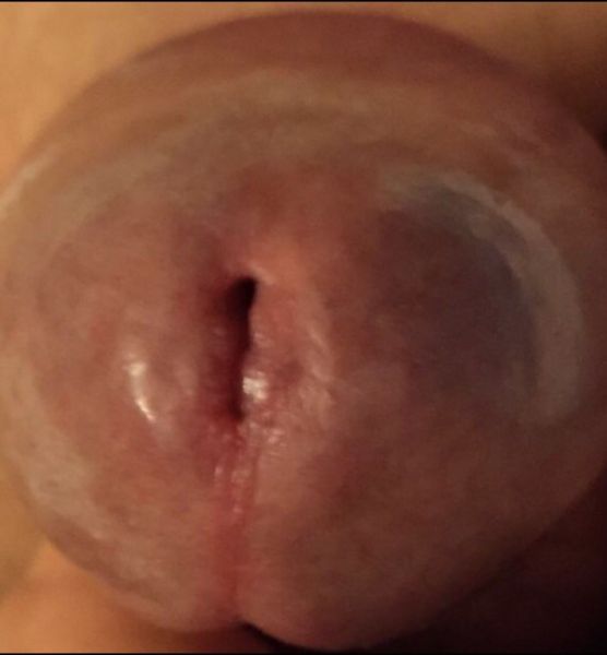 uncut erect penis glans