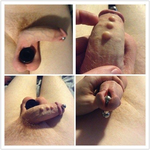 male penis modification