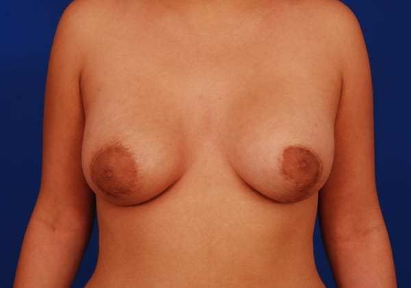 tubular puffy breasts t shirt