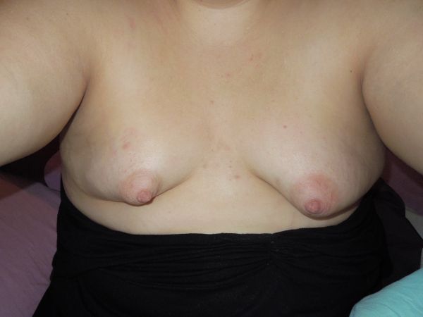 bullet shaped breasts