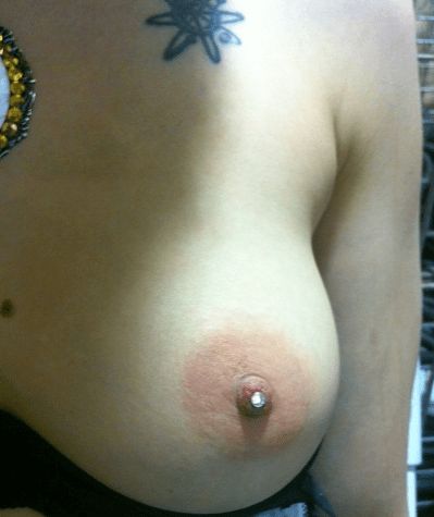 swollen nipple tumblr