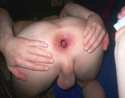gay male anus