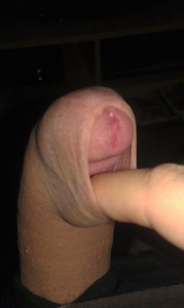 foreskin porn