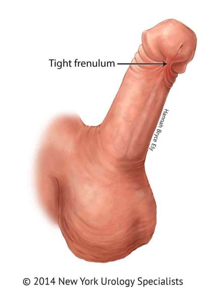 shaved scrotum