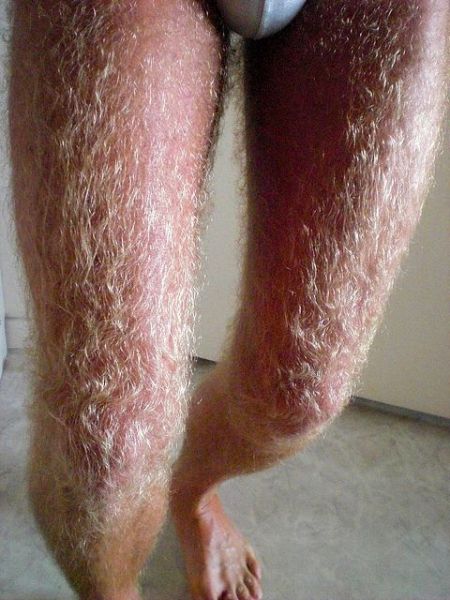 hairy hairy legs
