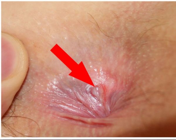 breast nipple penetration