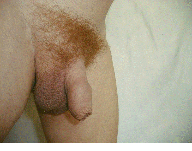penis gay penis