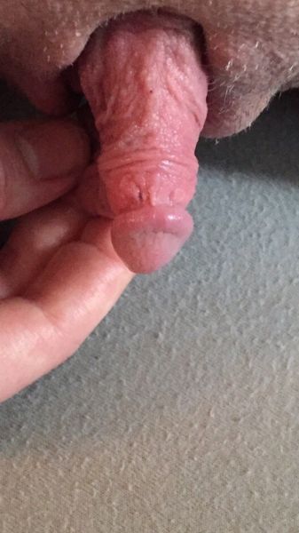 clitoris xxx