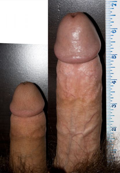 nude beach penis size