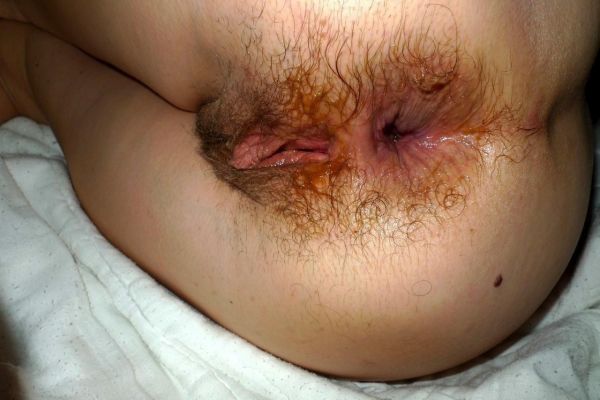 blonde anus
