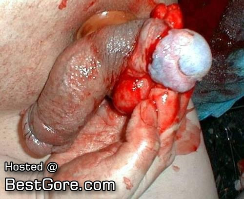 erect clitoris close up