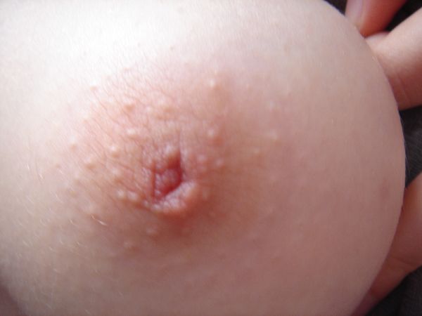 mature erect nipples